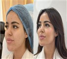 کلینیک جراحی زیبایی الماس (بدن و صورت) - نمونه جراحی‌های اخیر
