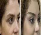 کلینیک جراحی زیبایی الماس (بدن و صورت) - نمونه جراحی‌های اخیر