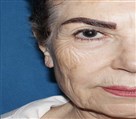 کلینیک جراحی زیبایی الماس (بدن و صورت) - نمونه جراحی‌های اخیر