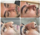 کلینیک جراحی زیبایی الماس (بدن و صورت) - نمونه جراحی‌های اخیر