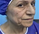 کلینیک جراحی زیبایی الماس (بدن و صورت) - نمونه جراحی‌های اخیر