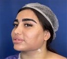 کلینیک جراحی زیبایی الماس (بدن و صورت) - نمونه جراحی‌های اخیر
