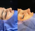 کلینیک جراحی زیبایی الماس (بدن و صورت) - نمونه جراحی‌های اخیر