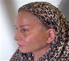کلینیک جراحی زیبایی الماس (بدن و صورت) - نمونه جراحی‌های اخیر