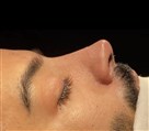 کلینیک جراحی زیبایی الماس (بدن و صورت) - نمونه جراحی‌های اخیر