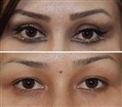 کلینیک جراحی زیبایی الماس (بدن و صورت) - نمونه جراحی‌های اخیر