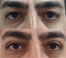کلینیک جراحی زیبایی الماس (بدن و صورت) - نمونه جراحی‌های اخیر