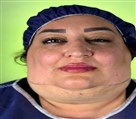 کلینیک جراحی زیبایی الماس (بدن و صورت) - نمونه جراحی‌های اخیر