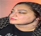 کلینیک جراحی زیبایی الماس (بدن و صورت) - نمونه جراحی‌های اخیر