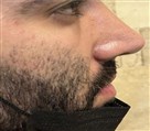 کلینیک جراحی زیبایی الماس (بدن و صورت) - نمونه جراحی‌های اخیر
