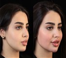 کلینیک جراحی زیبایی الماس (بدن و صورت) - نمونه جراحی‌های اخیر
