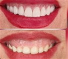 کلینیک جراحی زیبایی الماس (بدن و صورت) - نمونه جراحی‌های اخیر