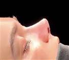 کلینیک جراحی زیبایی الماس (بدن و صورت) - نمونه جراحی‌های اخیر