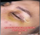 کلینیک جراحی زیبایی الماس (بدن و صورت) - نمونه جراحی‌های اخیر