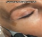 کلینیک جراحی زیبایی الماس (بدن و صورت) - نمونه جراحی‌های اخیر