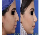 کلینیک جراحی زیبایی الماس (بدن و صورت) - تصویر 121479