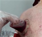 خدمات طب سنتی مجتمع درمانی میثم - برای رفع گرفتگی عضلات و اکسیژن رسانی بیشتر و تنظیم جریان خون و...