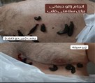 خدمات طب سنتی مجتمع درمانی میثم - تصویر 122610