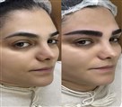 مرکز میکروبلیدینگ و آرایش دائم بیتا محرابی - تصویر 126673