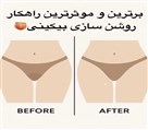 بیوتی شاپ فاران (نمایندگی روشن کننده ژنیتال Revo و Jessner) - تصویر 134153