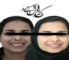 مركز ارتودنسى دكتر غزل شبانكاره - تصویر 135976