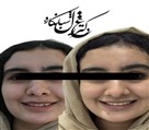 مركز ارتودنسى دكتر غزل شبانكاره - تصویر 135980