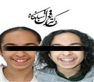 مركز ارتودنسى دكتر غزل شبانكاره - تصویر 135981