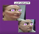 کلینیک زیبایی زرین - جوانسازی صورت