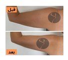 کلینیک لاغری و ماساژ سانی ماه - تصویر 138511