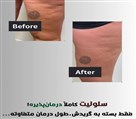 کلینیک لاغری و ماساژ سانی ماه - تصویر 138512