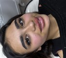کلینیک زیبایی پوست مو لیزر الین - تصویر 140661