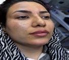 کلینیک زیبایی پوست مو لیزر الین - تصویر 140669