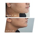 کلینیک زیبایی الین - تصویر 140733