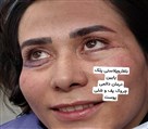 کلینیک زیبایی الین - تصویر 140734