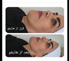 کلینیک زیبایی الین - تصویر 140736