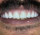 لابراتوار تخصصی پروتز های دندانی روگا - تصویر 140843