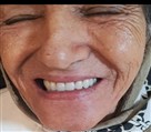 لابراتوار تخصصی پروتز های دندانی روگا - تصویر 140845
