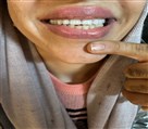 لابراتوار تخصصی پروتز های دندانی روگا - تصویر 140850