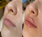 کلینیک زیبایی دکتر خاطره مختاری نیا - تصویر 143265