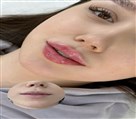 کلینیک زیبایی دکتر خاطره مختاری نیا - تصویر 143270