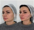 کلینیک زیبایی دکتر خاطره مختاری نیا - تصویر 143272