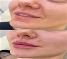 کلینیک زیبایی دکتر خاطره مختاری نیا - تصویر 143274
