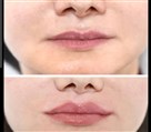 کلینیک زیبایی دکتر خاطره مختاری نیا - تصویر 143277