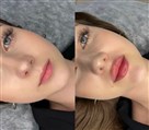 کلینیک زیبایی دکتر خاطره مختاری نیا - تصویر 143279
