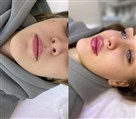 کلینیک زیبایی دکتر خاطره مختاری نیا - تصویر 143280
