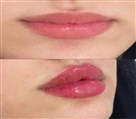 کلینیک زیبایی دکتر خاطره مختاری نیا - تصویر 143281