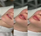کلینیک زیبایی دکتر خاطره مختاری نیا - تصویر 143283