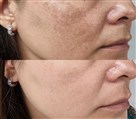 کلینیک زیبایی دکتر خاطره مختاری نیا - تصویر 143286