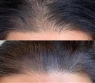 کلینیک زیبایی دکتر خاطره مختاری نیا - تصویر 143287