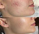 کلینیک زیبایی دکتر خاطره مختاری نیا - تصویر 143290